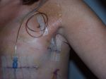 SURGERY 004.jpg