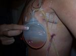 SURGERY 005.jpg