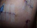 SURGERY 007.jpg