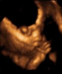 baby.JPG