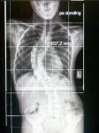 Spine419.jpg