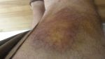 Agility Injury.JPG